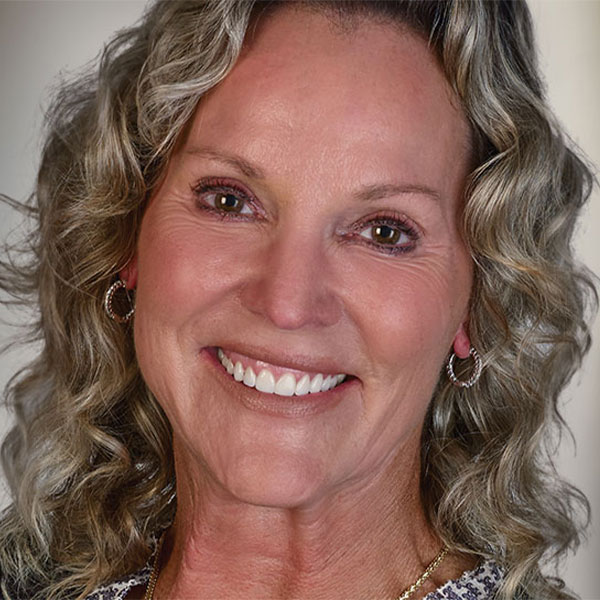 Reconstructive-Dentistry-bucket - Rochester Advanced Dentistry female patient with a reconstructed smile